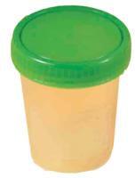 URINBECHER mit Schraubdeckel - 1St