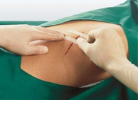 LEUKOSTRIP Wundnahtstreifen 4x38 mm Box - 50X8St