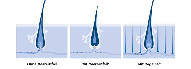 5-REGAINE_Wirkweise-Männer_770px.jpg