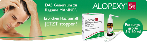 alopexy_haarausfall_unten