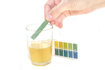 Urintest für zuhause: Eine Hand hält einen Harnteststreifen, der unter anderem Glucose im Urin messen kann.