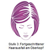 pds_regaine_frauenschaum_stufe3.jpg